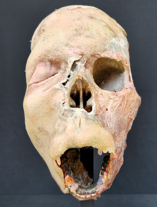 Dessicated Vampire Head