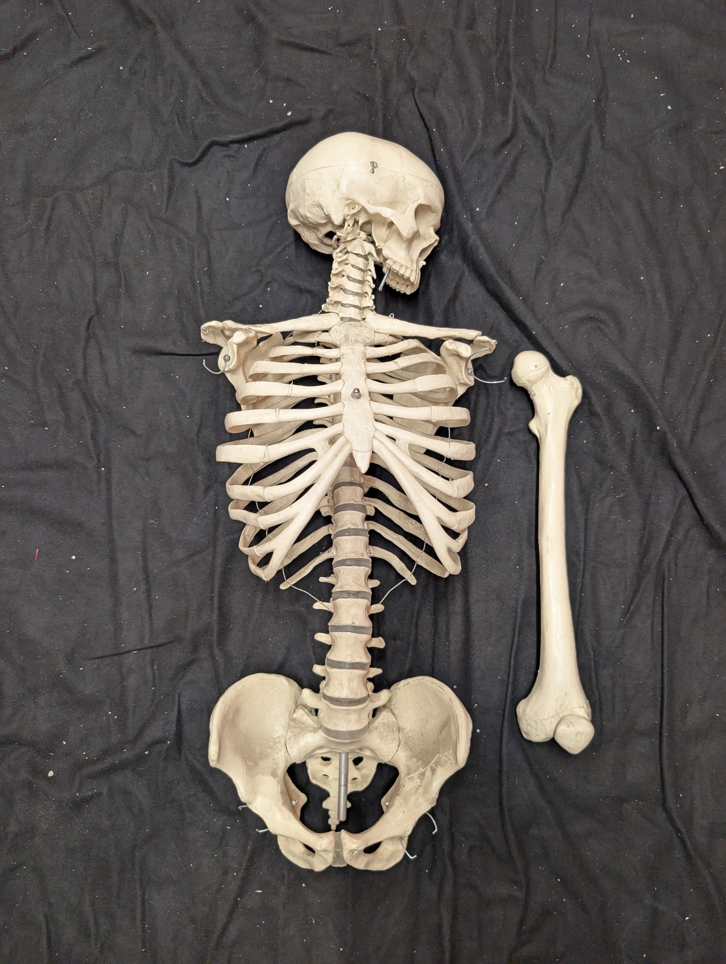 Human Rib Cage and Spine, with Skull